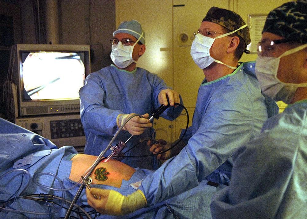 Understanding Appendicitis
