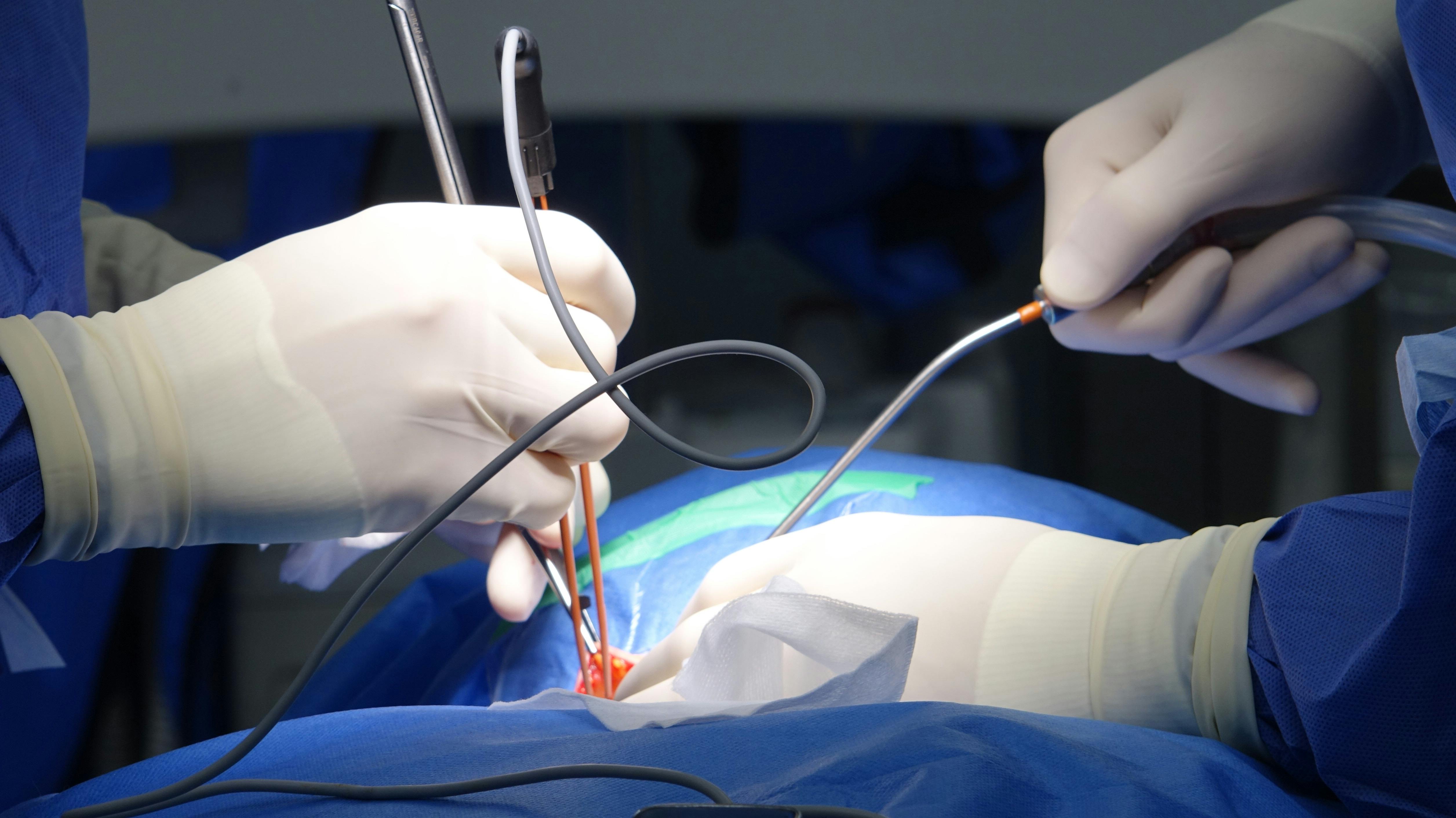 Surgical equipment