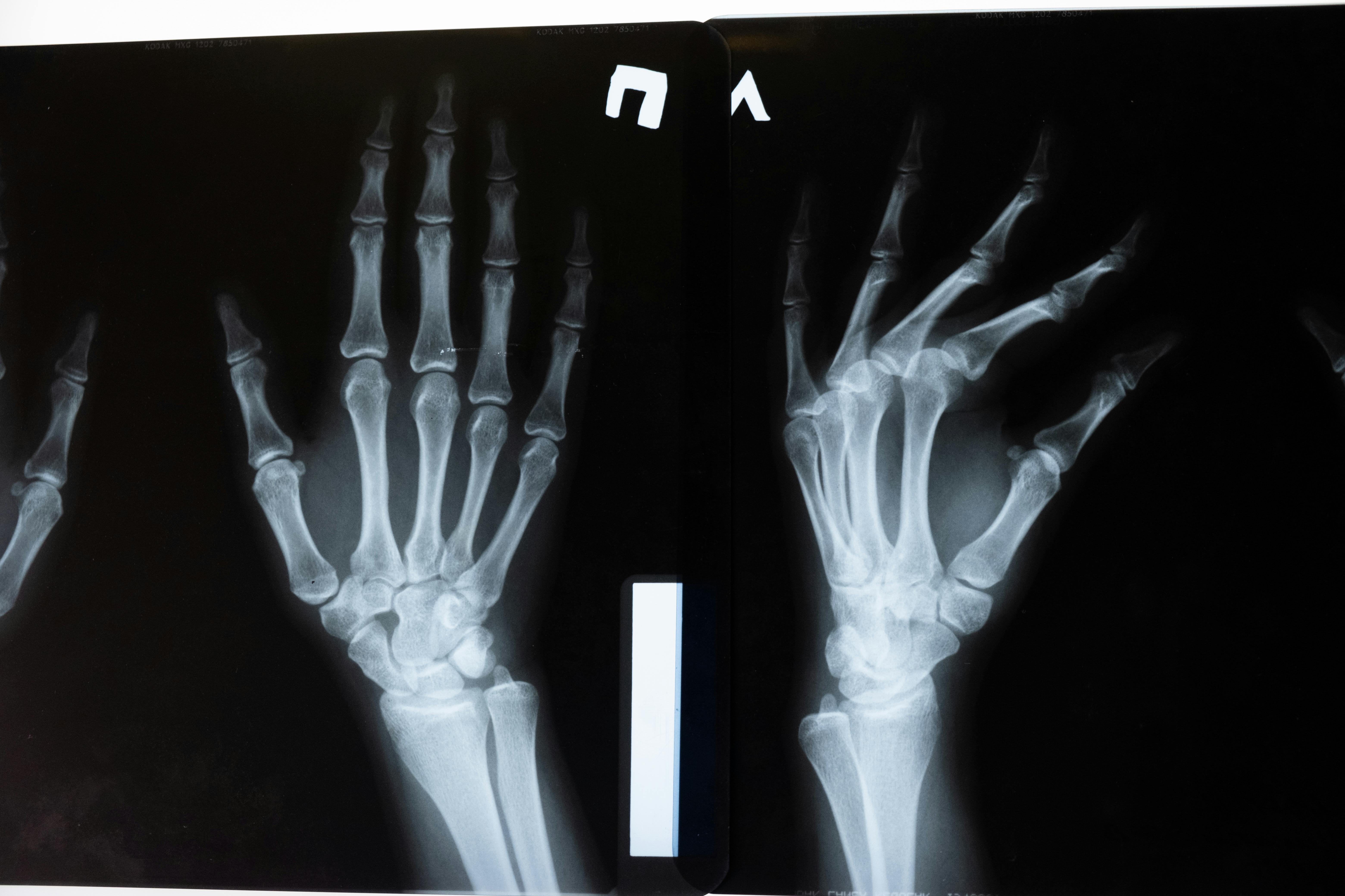 Radiology equipment