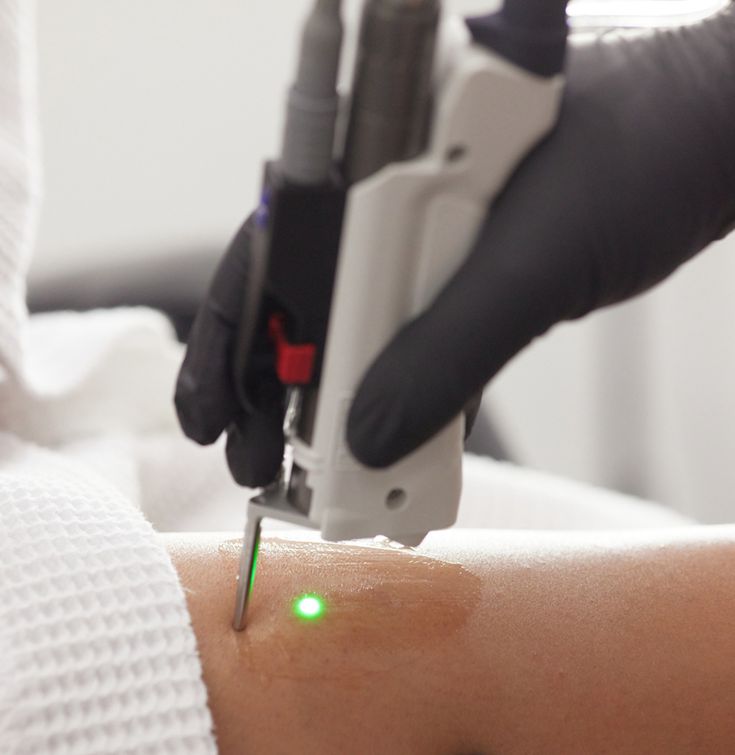 دليل عروض ليزر إزالة الشعر رمضان الخبر في مستشفى الرحيمي لعام 2026