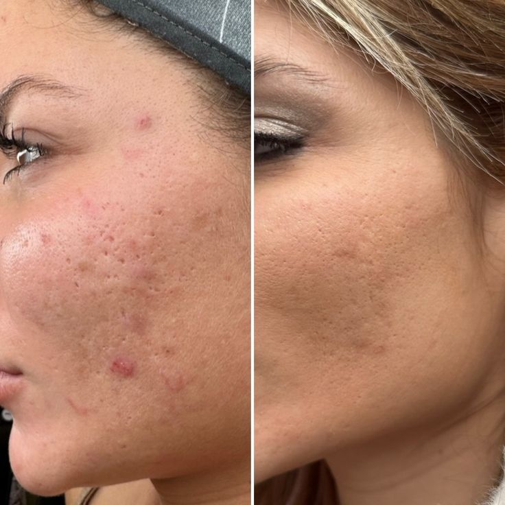 دليلك الشامل حول خدمات وسعر جلسة تفتيح البشرة الشرقية في مستشفى الرحيمي